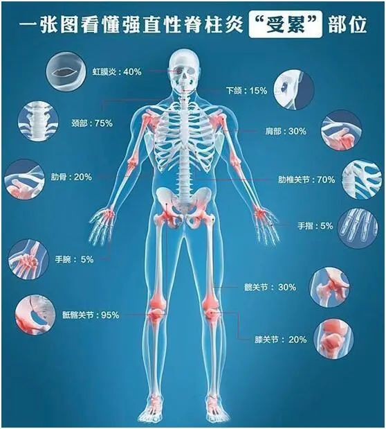 年轻人无缘无故腰背痛该注意啦